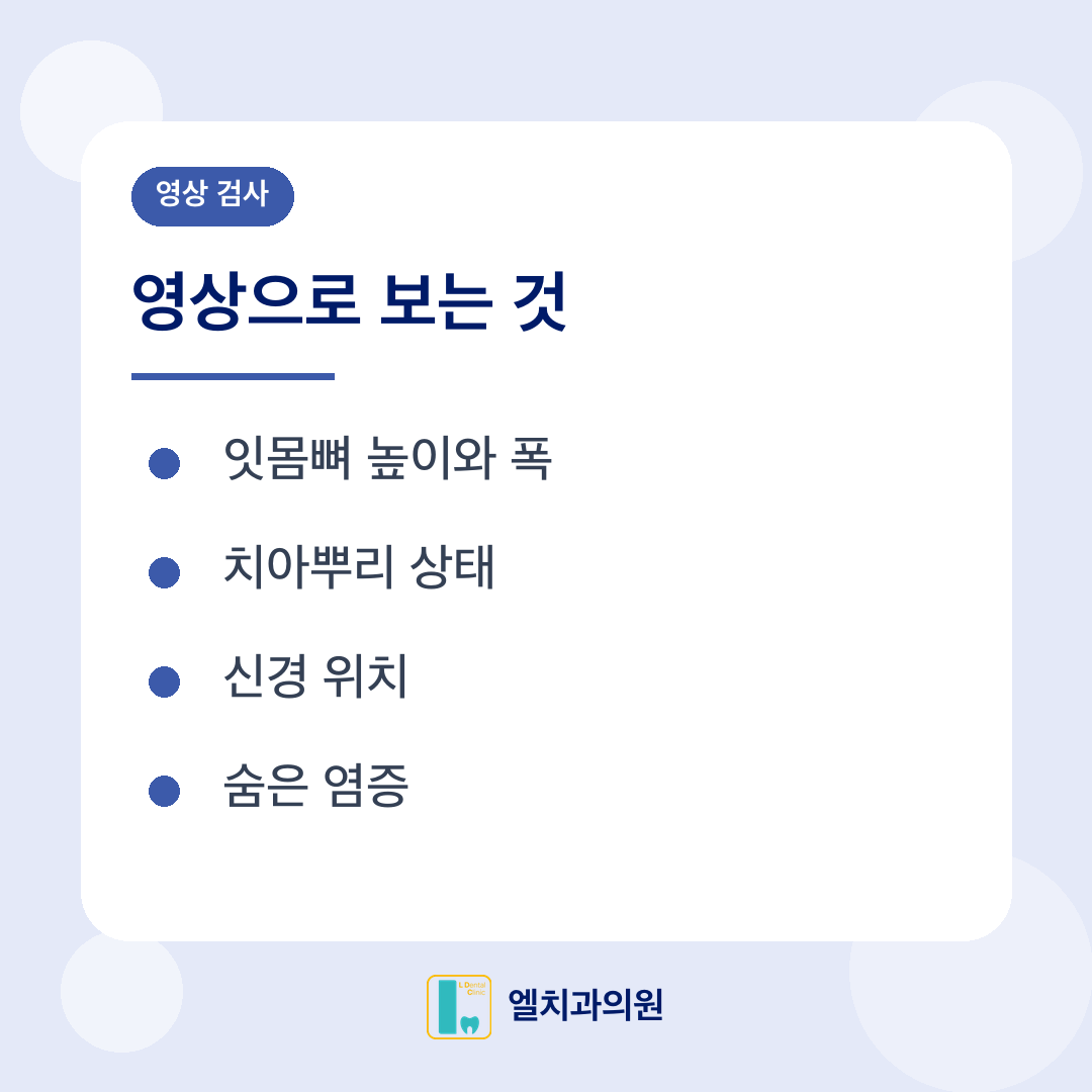 영상 검사 카드